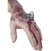 Bolted Up Wound