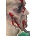 Small Scar Cut