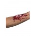 Broken Bone Scar