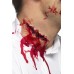 Stitches Scar