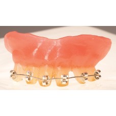 Braces Teeth                                                   